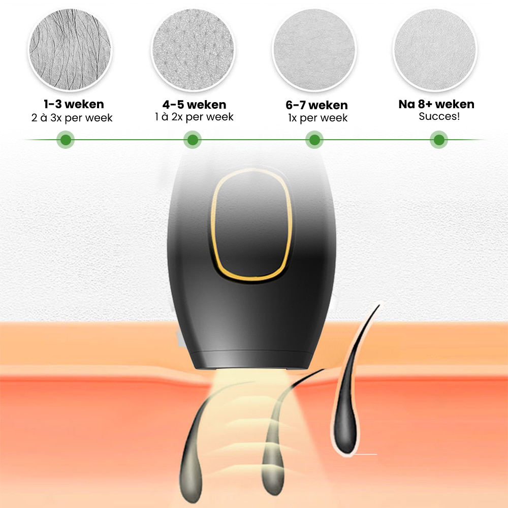 GlowFree – Schmerzfreie Laser-Haarentfernung für dauerhaft seidenglatte Haut | 50% RABATT