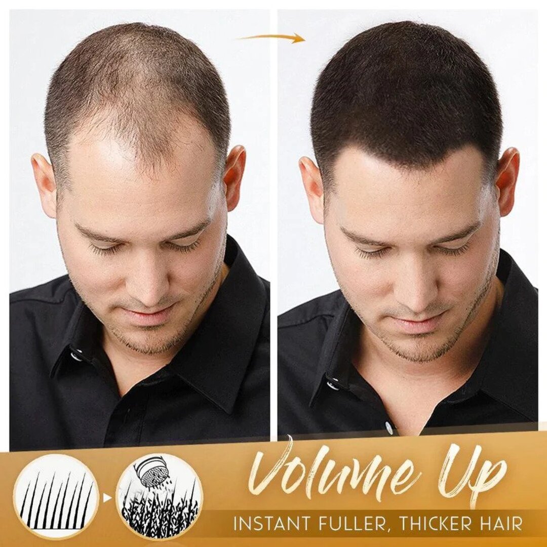 FluffUp™️ - Sofort volleres Haar | 1+1 GRATIS